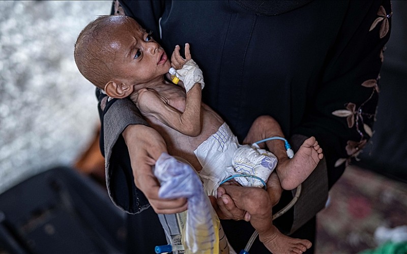 İsrail ablukası altındaki Gazze'de iki bebek daha açlıktan hayatını kaybetti İsrail ablukası altındaki Gazze'de iki bebek daha açlıktan hayatını kaybetti