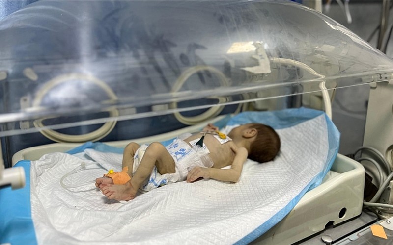 BM: Gazze'deki bebeklerin yüzde 92'si temel gıdalardan yoksun BM: Gazze'deki bebeklerin yüzde 92'si temel gıdalardan yoksun